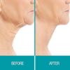 Dermactin-TS Crepe Be Gone Body Souffle 3 ounce (2-Pack) view 3