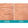 Dermactin-TS Crepe Be Gone Body Souffle 3 ounce (2-Pack) view 4