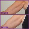 PRAI Beauty Ageless Upper Arm Creme, Anti-Aging and Repairing Body Cream, Skin Firming and Tightening Lotion for Upper Arm, Firming Lotion for Loose Skin, 3.9 Oz view 4