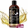 Urbangabru Onion Oil for Hair growth Organic | Onion Juice, Hair Oil for Dry Damaged Hair and Growth (8 Fl Oz) view 1