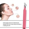 Blackhead Acne Extraction Tweezers - FEITA Pro & Surgical-Grade Stainless Steel Bend Curved Comedone Extractor Tweezer Tool for Remove Whitehead and Clogged Pores, Pimple - Pink view 2