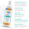 Almond Clear Face & Body Wash [6.7 Fl Oz] Skin Care for Acne and Folliculitis-Prone Skin - Gentle Everyday Exfoliating Cleanser with Mandelic Acid and Botanicals view 2