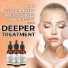 Jeune Naturelle Sea Buckthorn Oil Organic, From Fruit & Seeds, 100% Pure RAW Virgin Cold-Pressed Undiluted Unrefined, Fast Absorbing, Travel Size, Non-Comedogenic view 4