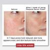 Thayers Witch Hazel with Aloe Vera - Default 12 Rose Petal, 12 Fl Oz view 2