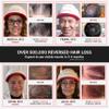 iRestore Professional Laser Red Light Therapy for Hair Growth System - FDA Cleared Hair Loss, Hair Thinning & Alopecia Treatment for Men & Women - 282 Lasers & LEDs view 2