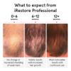 iRestore Professional Laser Red Light Therapy for Hair Growth System - FDA Cleared Hair Loss, Hair Thinning & Alopecia Treatment for Men & Women - 282 Lasers & LEDs view 3