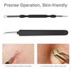 JPNK Blackhead Remover Tool Comedones Extractor Acne Removal Kit for Blemish, Whitehead Popping, 6 Pcs Zit Removing for Nose Face Tools with a Leather Bag (Black) view 4
