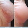 Australian Bodycare Cracked Heel Repair Cream 3.38 OZ view 4