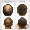 THICK FIBER Hair Fibers for Thinning Hair & Bald spots (DARK BROWN) - 25g Bottle - Conceals Hair Loss in Seconds - Hair Powder for Women & Men view 2