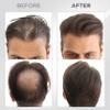 THICK FIBER Hair Fibers for Thinning Hair & Bald spots (DARK BROWN) - 25g Bottle - Conceals Hair Loss in Seconds - Hair Powder for Women & Men view 3
