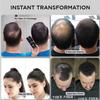 THICK FIBER Hair Fibers for Thinning Hair & Bald spots (BLACK) - 25g Bottle - Conceals Hair Loss in Seconds - Hair Powder for Women & Men view 2