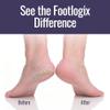 Footlogix Foot Care Callus Softener Combo - Callus Remover Spray & Double-Sided Foot File for Dry, Cracked Heels, Pedicure Tools for Feet, Foot Exfoliator view 4