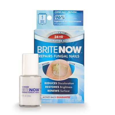 ProClearz Brite Now Nail Treatment, Restores The Appearance Of Damaged & Discolored Nails, Peel-Away Technology, Brightening & Smoothing Nail Repair, 0.5 Ounce