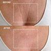 Wrinkles Schminkles Chest, Cleavage & Body Stretch Mark Wrinkle Patches | Reusable Hypoallergenic Pregnancy Safe Silicone Smoothing Pads to Prevent and Reduce Wrinkles & Stretch Marks | 2 Pack view 3