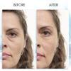 Puffy Eye GEL Instant results  Naturally rapid reduction eye gel, Eliminate Wrinkles, Puffiness and Bags  Hydrating Eye Gel w/Green Tea Extract by Aqua Mineral  1 oz view 2