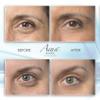 Puffy Eye GEL Instant results  Naturally rapid reduction eye gel, Eliminate Wrinkles, Puffiness and Bags  Hydrating Eye Gel w/Green Tea Extract by Aqua Mineral  1 oz view 3