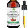 Rosehip Oil - Pure, Virgin, Cold Pressed - From Whole Berries (Pulp & Seeds), Natural Deep Orange Hue for Intensive Skin Repair - Undiluted Organic Rosehip Seed Oil, 2 oz view 1