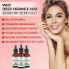 Rosehip Oil - Pure, Virgin, Cold Pressed - From Whole Berries (Pulp & Seeds), Natural Deep Orange Hue for Intensive Skin Repair - Undiluted Organic Rosehip Seed Oil, 2 oz view 4