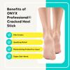 Onyx Professional Cracked Heel Repair Balm Stick for Dry Cracked Feet Treatment, Coconut Scent, 1 pack - Moisturizing Foot Balm, Rolls On, No Mess Like Foot Cream or Foot Lotion, Heel Treatment view 3
