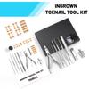 2026 Upgraded Ingrown Toenail Removal Kit, Ingrown Toenail Treatment, Stainless Steel Ingrown Toenail Corrector, Surgery Grade Ingrown Toenail Tool Tool By Dualeco view 2