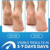 2 in 1 Foot Cream for Dry Cracked Heels - XL Foot Repair Cream for Dry Feet - Suitable for Diabetics - Used by Professionals view 2