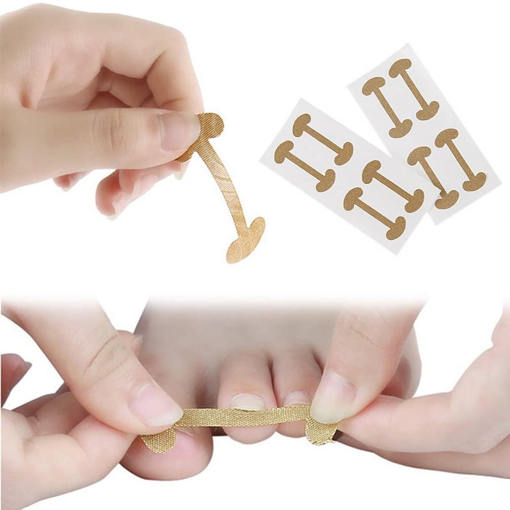 Toenails Correction Patch, Physical Straightening Elastic Cotton Glue Patch Toenail Pedicure Tool, Curved Toenails Brace Correction (20PCS)