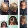100% Real Human Hair Clip in Hair Topper with Side Bangs, Hand-made Mono Toupee for Women with Thinning Hair, 12" 613# Blonde view 3