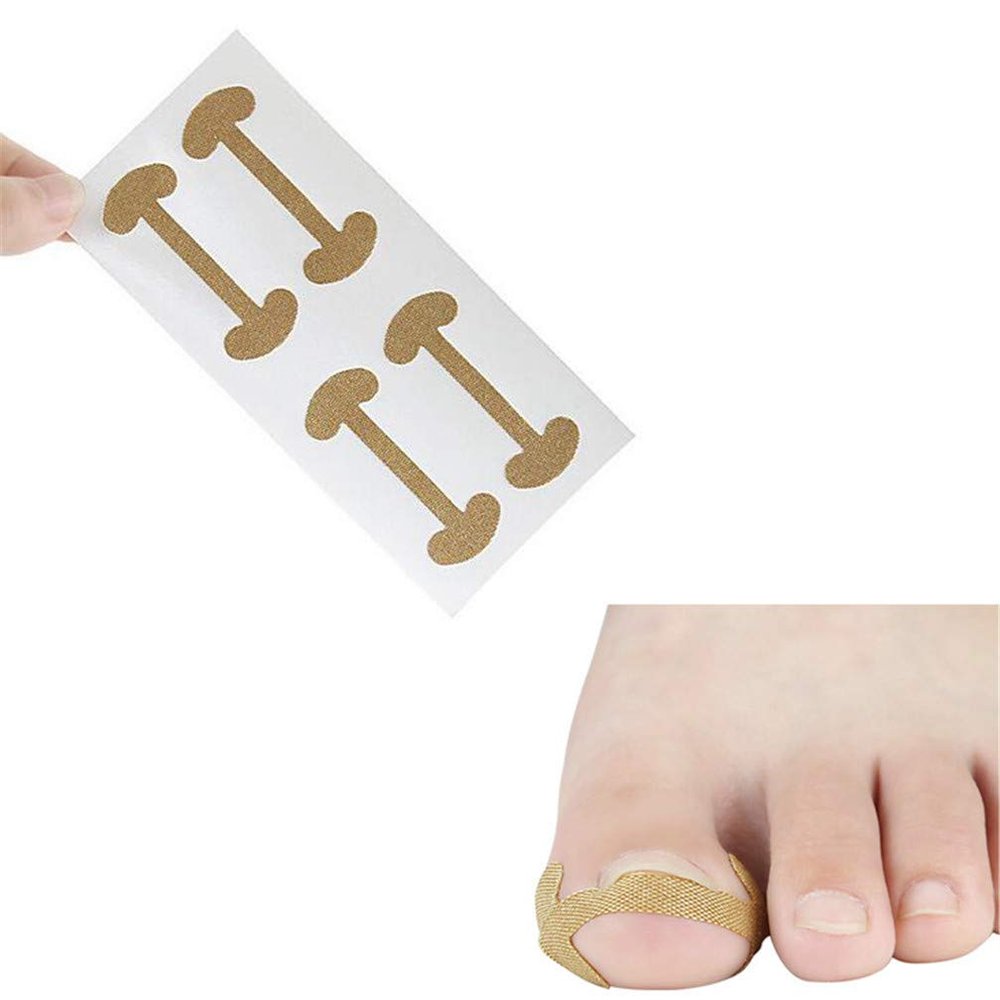 Ingrown Toenails Correction Patch, 20 PCS Physical Straightening Elastic Cotton Glue Patch Toenail Pedicure Tool, Curved Toenails Brace Thick Paronychia Correction Recover Treatment Tool