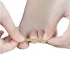 Ingrown Toenails Correction Patch, 20 PCS Physical Straightening Elastic Cotton Glue Patch Toenail Pedicure Tool, Curved Toenails Brace Thick Paronychia Correction Recover Treatment Tool view 4