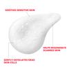 TETRAFORCE Acne Care Foam Cleanser for Calming and Clearing Irritated Skin with Cica Tea Tree Extract Deep Cleansing Face Wash for all Skin types Korean Skincare(150g,5.29oz) K beauty view 2