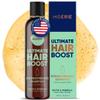 Moerie Ultimate Hair Growth Shampoo  For Longer, Thicker, Fuller Hair - Vegan Friendly Volumizing Hair Products  Paraben & Silicone Free  All Hair Types  Reverse Hair Loss  8.45 fl oz (250ml) view 1