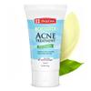 De La Cruz 5% Sulfur Ointment - Cystic Acne Treatment for Face and Body - Daily 10 Min Spot Treatment Mask - Safe and Effective Game Changing Hormonal Acne Treatment that Clears Up Pimples 2.6oz Tube view 1