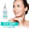 Bye Bye Blemish Skin Rescue Niacinamide Serum view 2