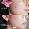 Handmade Heroes 2% Bakuchiol Oil Lifting and Firming Oil for Guasha Neck, and Dcollet, All Natural Retinol Alternative For Radiant and Line Smoothing 0.75oz view 2