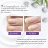 Nail Tek Foundation Xtra 4, Ridge Filling Strengthening Base Coat for Weak and Damaged Nails, 0.5 oz, 2-Pack view 2