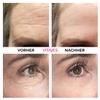 VITAYES Instant Ageback Lifting Cream, Dark Circle Bags Under Eye Remover, Anti Wrinkle and Fine Lines Face Lift Cream 0.24 Oz view 2