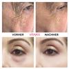 VITAYES Instant Ageback Lifting Cream, Dark Circle Bags Under Eye Remover, Anti Wrinkle and Fine Lines Face Lift Cream 0.24 Oz view 3