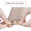 EBANKU Ingrown Toenail Treatment Strips, 20 Pcs Toe Nail Correction Patch Elastic Patch Sticker Corrector Pedicure Tools Fingernail Toe Nail Care view 2