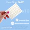 Acne Patches for Face - Hydrocolloid Bandages (360 Count) Pimple Patches for Face in 2 Universal Sizes, Acne Spot Treatment Care for Face & Skin Spot Patch Conceals Zits, Acne and Blackheads view 2