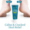 GILDEN TREE Urea Cream 40 Percent for Feet Maximum Strength Cracked Heel Treatment Foot Cream for Calluses and Dry Feet, Enriched with Shea Butter & Aloe for Moisturizing, Made in USA view 2