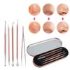5pcs Acne Pimples Needles Set Pimples Blackheads Removal Extractor Facial Cleansing Tool Kit view 4