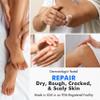 Ebanel Urea Cream 40% plus Salicylic Acid 2%, Foot Cream for Dry Cracked Heels Feet Knees Elbows Hands, Foot Dead Skin Cuticle Callus Remover Toenail Softener, Keratolytic Skin Barrier Repair view 4