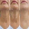 AminoGenesis N.E.C.K Control: Neck Lifting, Firming And Retracting Cream view 2