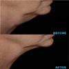 AminoGenesis N.E.C.K Control: Neck Lifting, Firming And Retracting Cream view 4