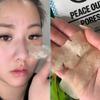 PEACE OUT Skincare Pore Minimizing Strips, Hydrocolloid Pore-Refining Nose and Face Strips with Retinol & Vitamin A to Shrink Enlarged Pores and Remove Blackheads (4 pore and 4 nose strips) view 4
