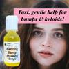 Urban ReLeaf Piercing Bump Shrinking Drops! Keloid Bumps Gentle Effective Aftercare Solution. Natural Essential Oils. Fast Removal Help for Scars Nodules Cartilage Nose Ear Spots. Clean Soothe view 2