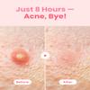 GLAM UP Hydrocolloid Blemish Pimple Zit Patches - Invisible Ultra Thin Spot Cover Stickers for Face and Skin, Strong Water-proof and Adhesive Overnight, Vegan-friendly (36 Count / 2 Sizes) view 3
