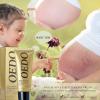 Rose Remove Stretch Marks Cream for Pregnancy Scar Removal Cream Natural Plant Essence Formula Prevention Remove Stretch Mark Old Scars Body Moisturizer 40g view 2