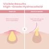 GLAM UP Hydrocolloid Blemish Pimple Zit Patches(180PCS/2Size) - Invisible Ultra Thin Spot Cover Stickers for Face and Skin, Strong Water-proof and Adhesive Overnight, Vegan-friendly view 2