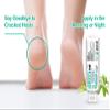 Clear 40, 40% Urea Gel, 8 oz w/Tea Tree & Coconut Oil, Aloe Vera Extract, Works on Calluses & Corns, Moisturizes & Softens Cracked Heels, Feet, Elbows, Hands, Nails, Superior Hydration to Urea Creams view 2